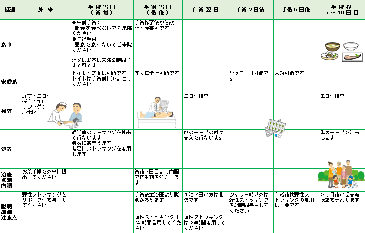 下肢静脈瘤について 地方独立行政法人 筑後市立病院 下肢静脈瘤について 地方独立行政法人 筑後市立病院