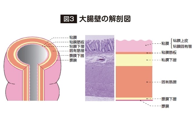 大腸壁の解剖図