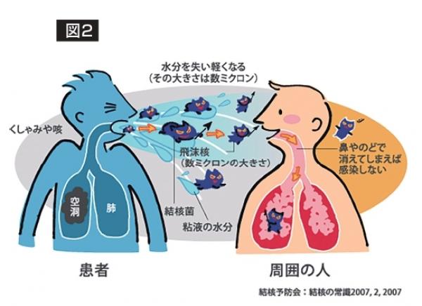 イラスト結核の感染と発病