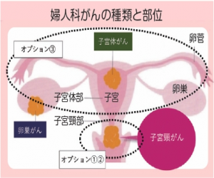 婦人科がんの種類と部位