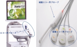 経膣エコー検査機械画像