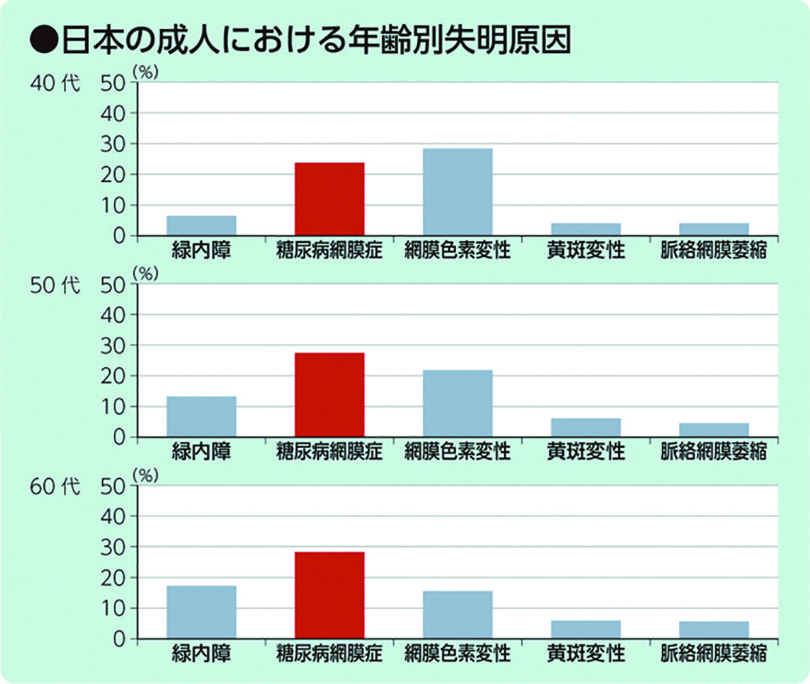 日本の成人における年齢別失明原因グラフ