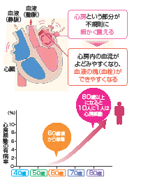 心房細動の仕組みと有病率