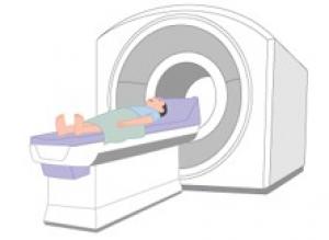 頭部MRI検査