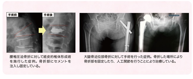 手術前後の写真