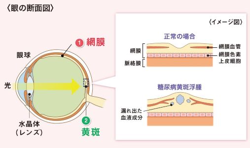 眼の断面図