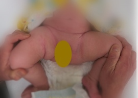 写真1 股関節の開きが悪い 写真1 股関節の開きが悪い