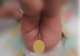 写真2 しわのかずが違う 写真2 しわのかずが違う