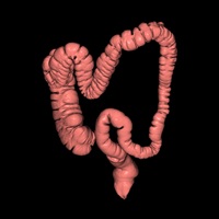 大腸3D 大腸3D